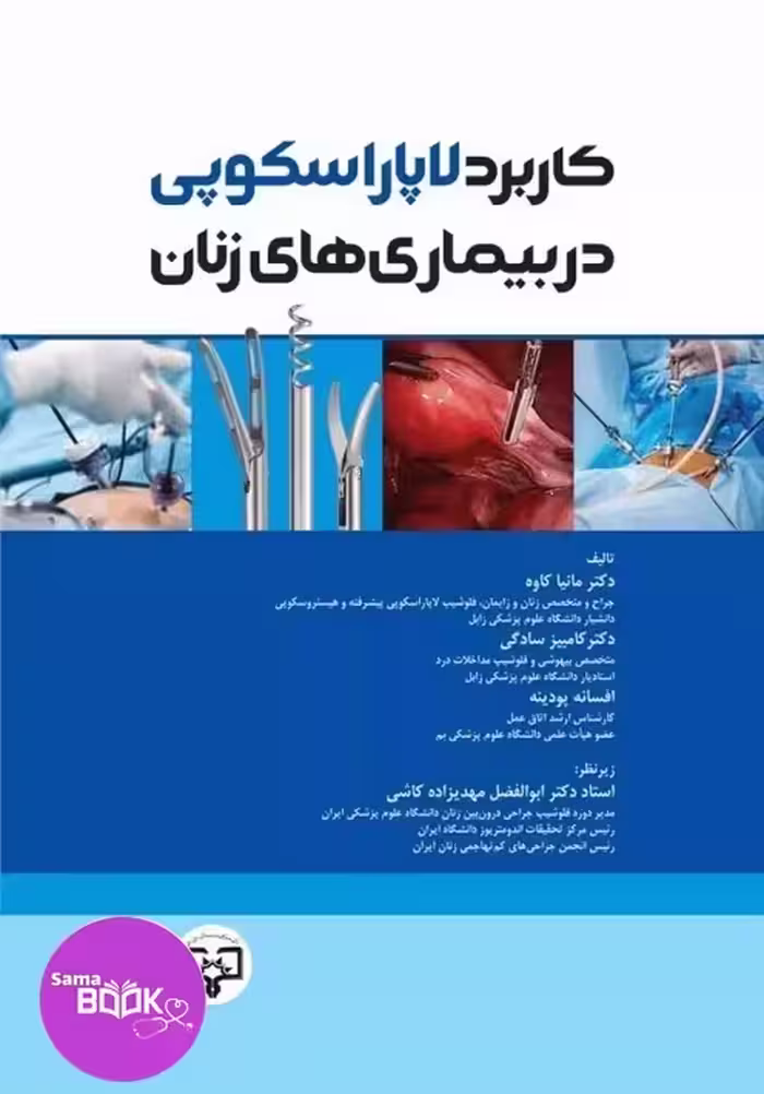 کاربرد لاپاراسکوپی در بیماری‌های زنان