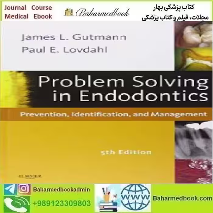 Problem Solving in Endodontics Prevention