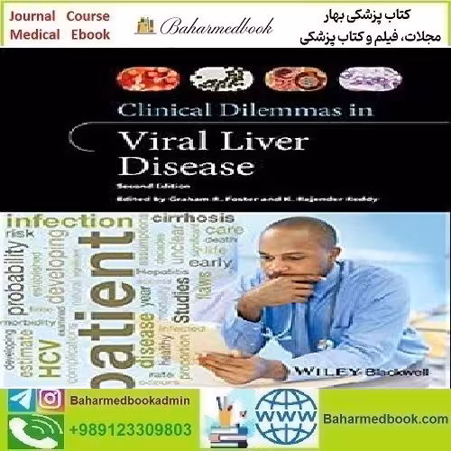 Clinical Dilemmas in Viral Liver Disease 2020 TRUE PDF price 1€ - کتاب پزشکی بهار