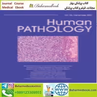 Human Pathology Volume 107 to 118 2021 TRUE PDF price 36€ - کتاب پزشکی بهار