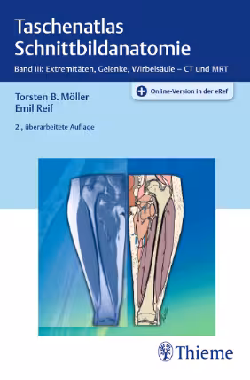 خرید و دانلود نسخه کامل کتاب Taschenatlas Schnittbildanatomie Band III: Extremitäten, Gelenke, Wirbelsäule – CT und MRT 2., überarbeitete Auflage 446 Abbildungen - Original PDF