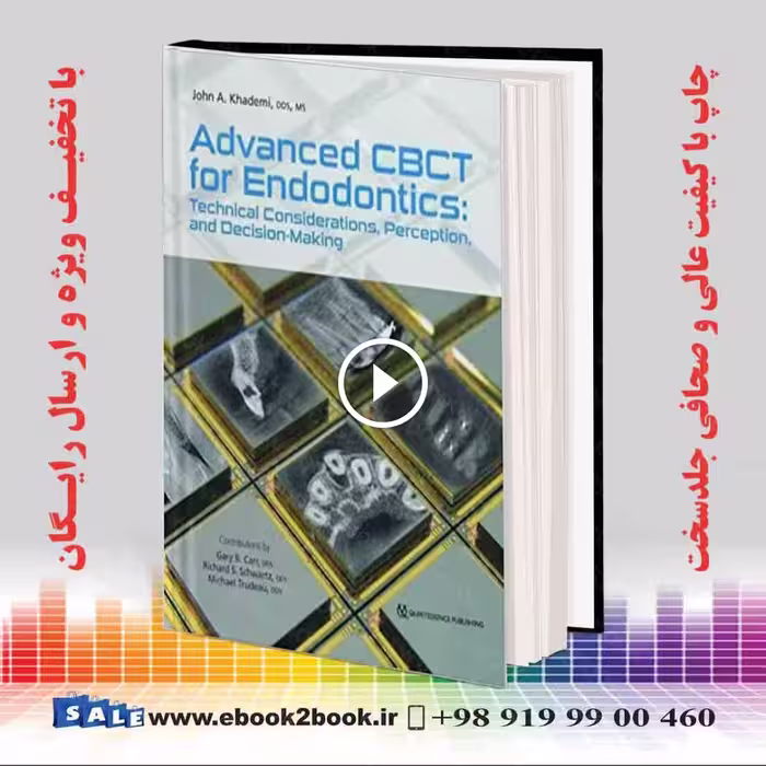 Advanced CBCT for Endodontics : Technical Considerations Perception and Decision-Making
