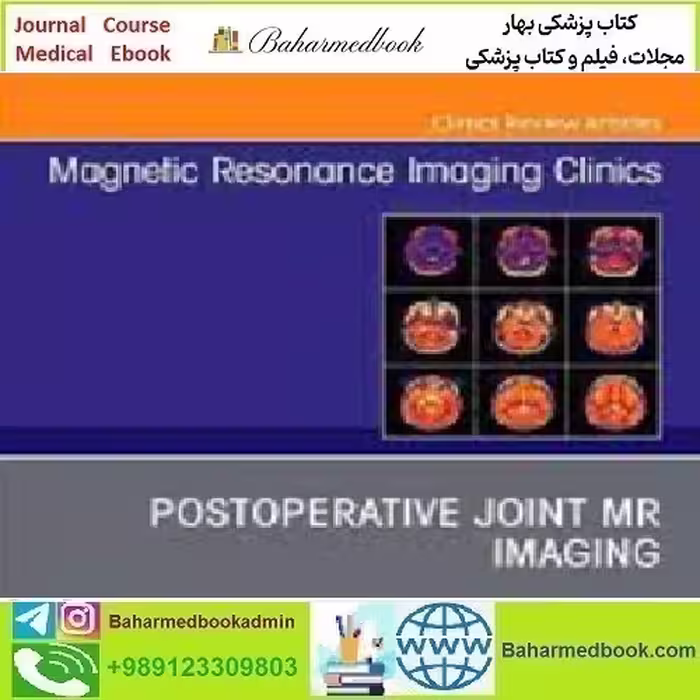 Magnetic Resonance Imaging Clinics of North America Volume 30
