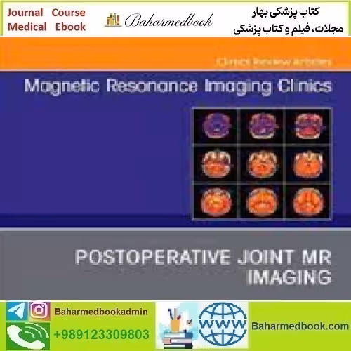 Magnetic Resonance Imaging Clinics of North America Volume 30