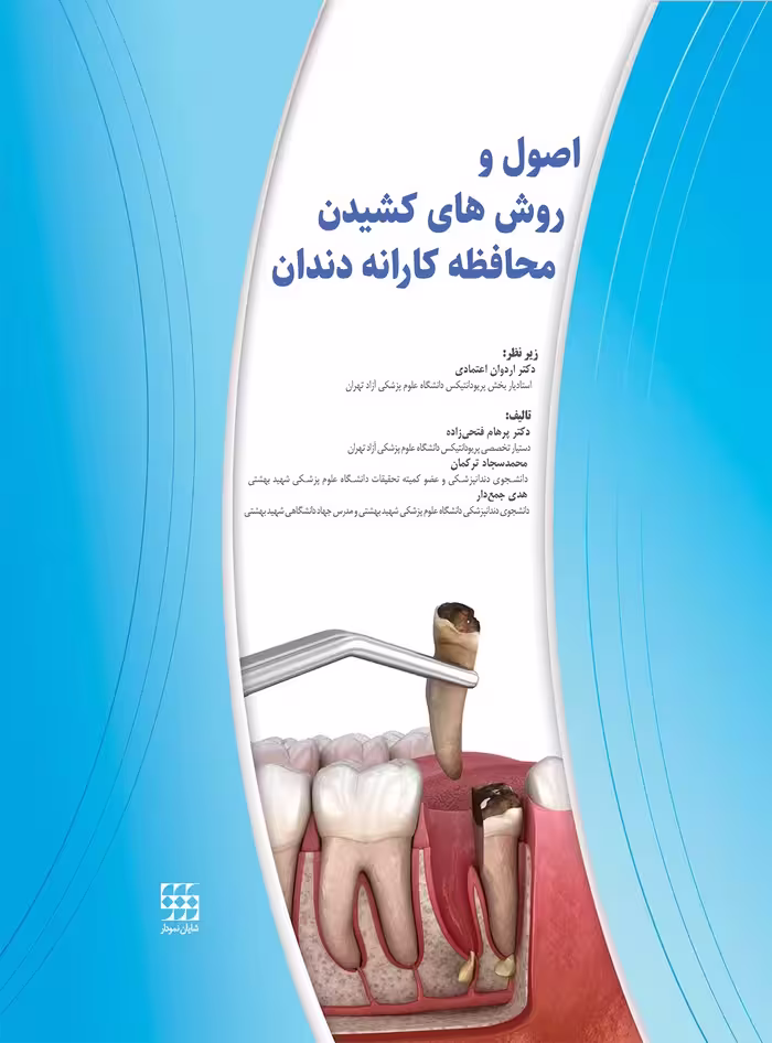 اصول و روش های کشیدن محافظه کارانه دندان