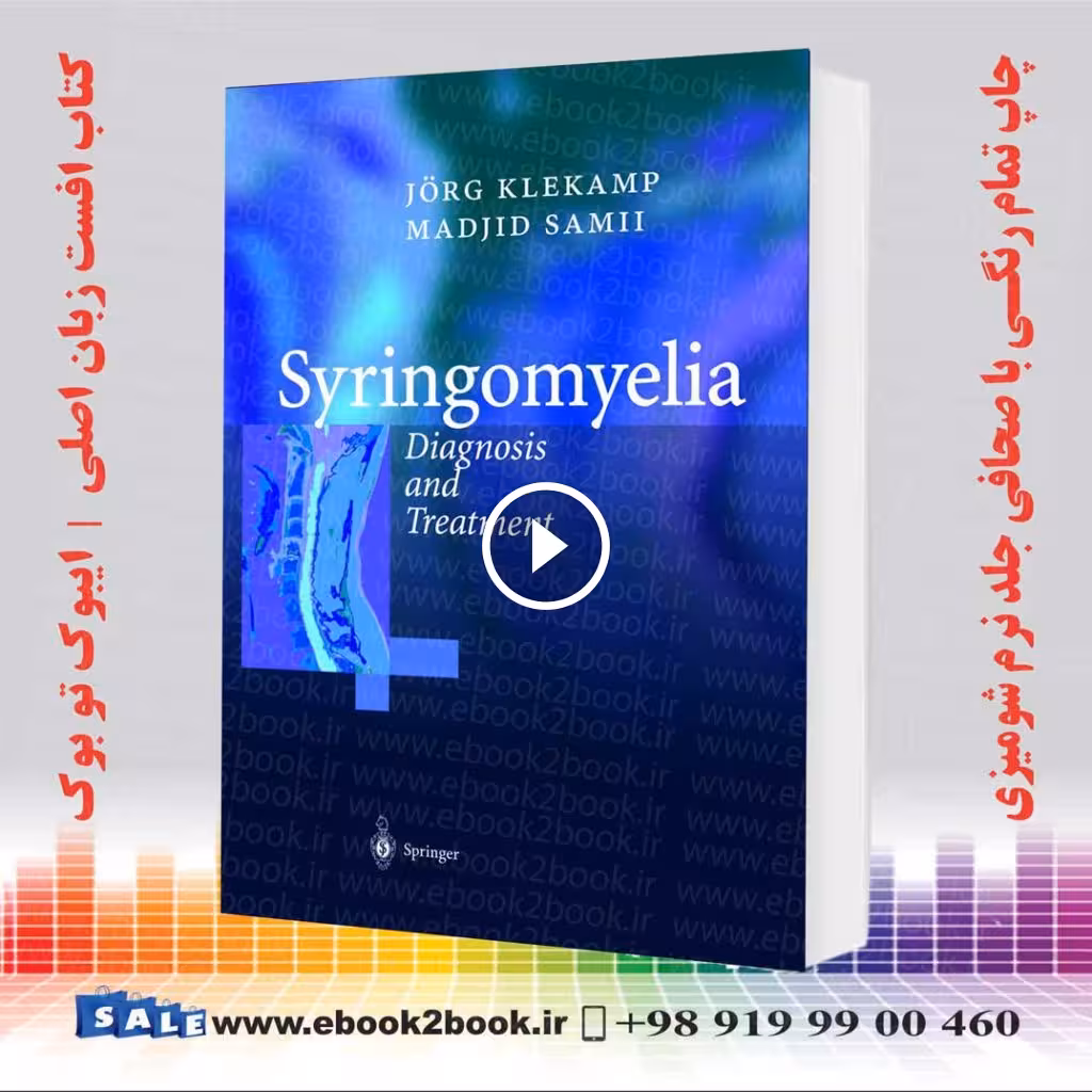 Syringomyelia: Diagnosis and Treatment