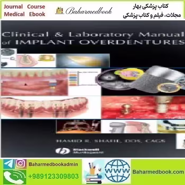 Clinical and Laboratory Manual of Implant Overdentures 2008 TR