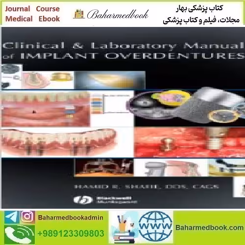 Clinical and Laboratory Manual of Implant Overdentures 2008 TR
