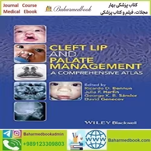Cleft Lip and Palate Management A Comprehensive Atlas 2
