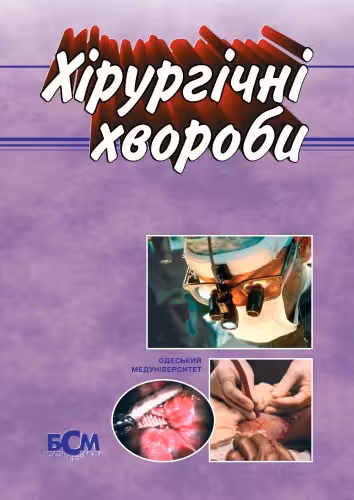 خرید و دانلود نسخه کامل کتاب Хірургічні хвороби. Підручник.