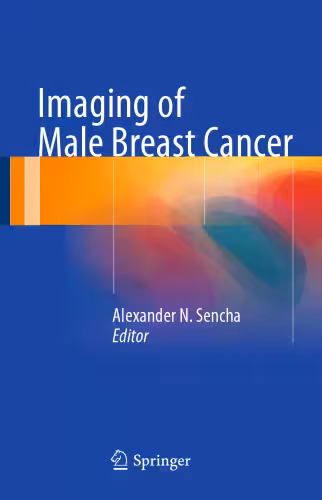 خرید و دانلود نسخه کامل کتاب Imaging of Male Breast Cancer