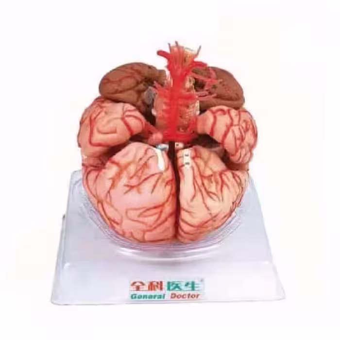 مولاژ مغز با نمایش عروق