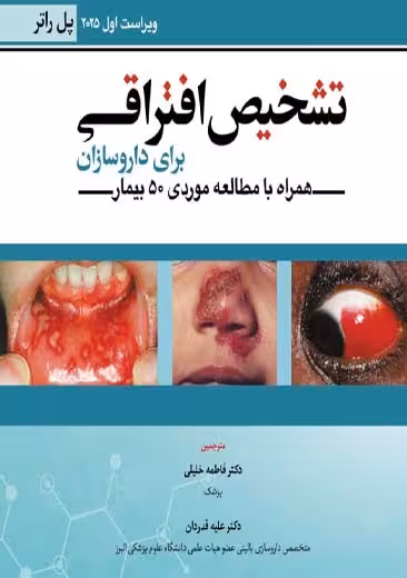 تشخیص افتراقی برای داروسازان ویراست اول راتر خلیلی آبادیس طب