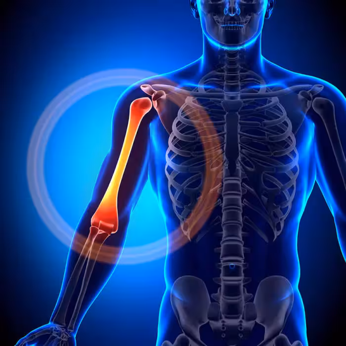 پاورپوینت آماده با موضوع آسیب شناسی عضلات