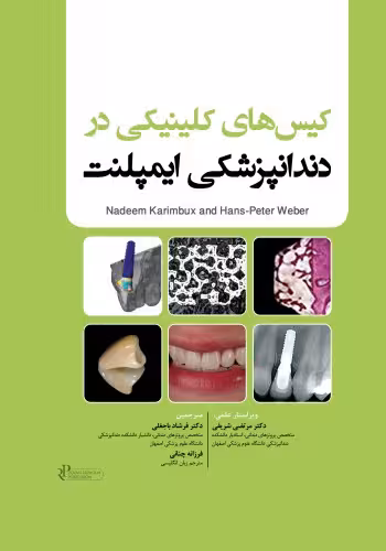 کیس های کلینیکی در دندانپزشکی ایمپلنت