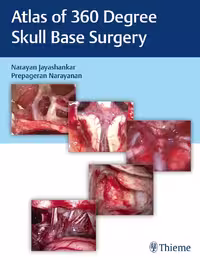 خرید و دانلود نسخه کامل کتاب Atlas of 360 degrees Skull Base Surgery - Orginal Pdf