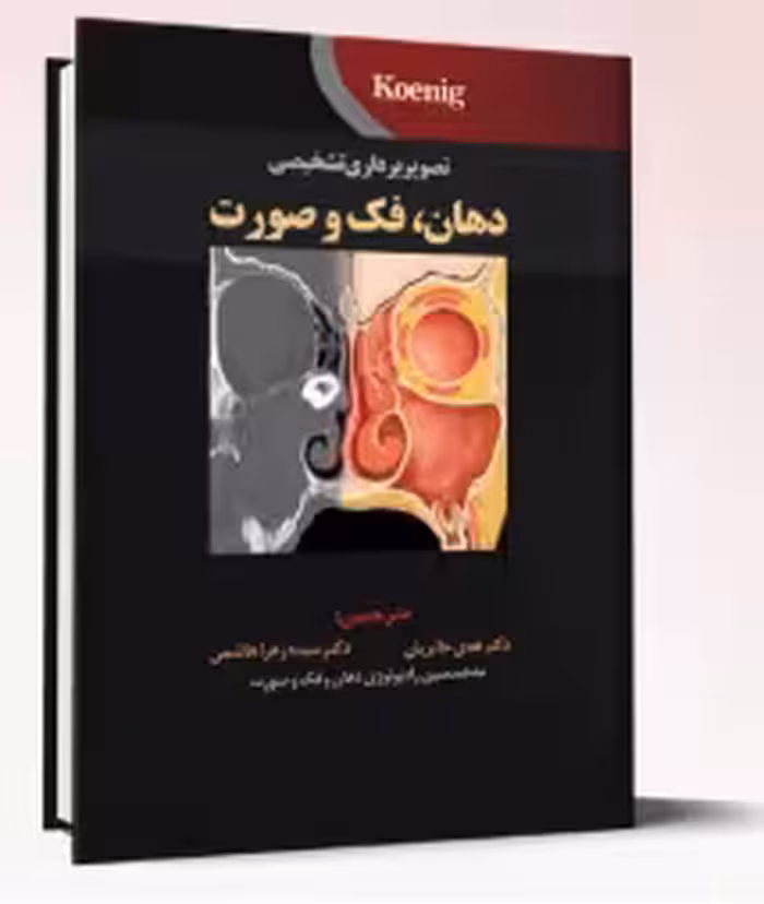 کتاب تصویربرداری تشخیصی دهان، فک و صورت – koenig