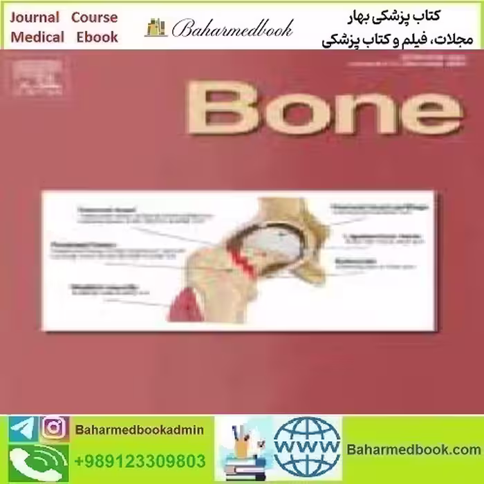Bone Volume 166 to 177 2023 TRUE PDF price 12€ - کتاب پزشکی بهار
