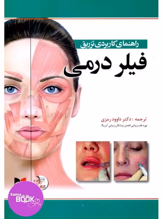 راهنمای کاربردی تزریق فیلر درمی