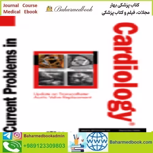 Current Problems in Cardiology Volume 46 Issue 1 to 12 2021 RU