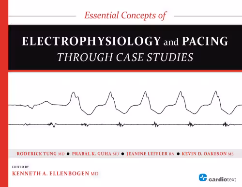 خرید و دانلود نسخه کامل کتاب Essential Concepts of Electrophysiology and Pacing through Case Studies