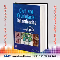 Cleft and Craniofacial Orthodontics