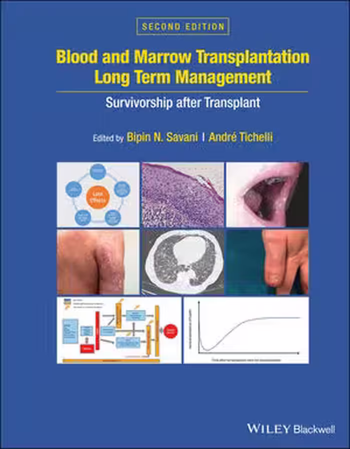 خرید و دانلود نسخه کامل کتاب Blood and Marrow Transplantation Long Term Management: Survivorship after Transplant, 2nd Edition