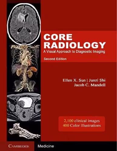خرید و دانلود نسخه کامل کتاب Core radiology : A Visual Approach To Diagnostic Imaging