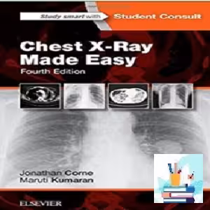 Chest X-Ray Made Easy TRUE PDF price 1€
