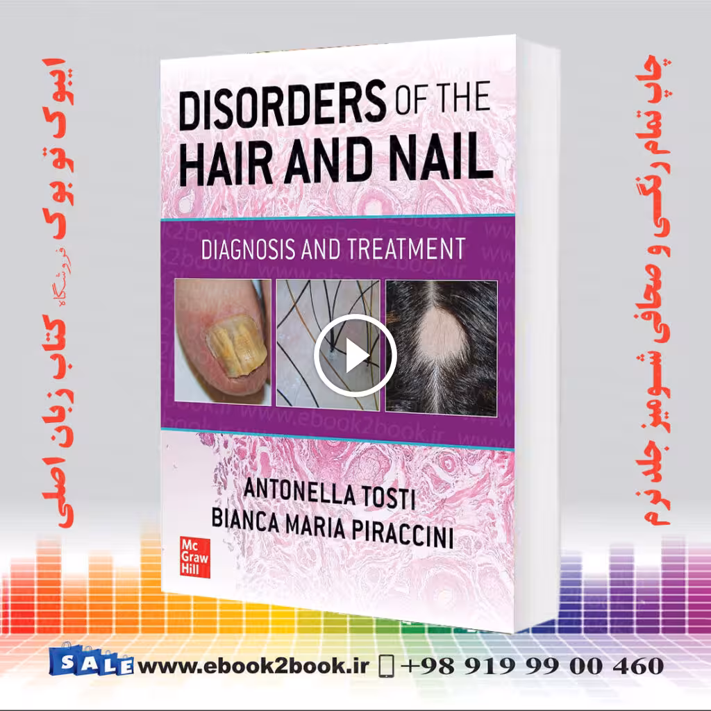 Disorders of the Hair and Nail: Diagnosis and Treatment