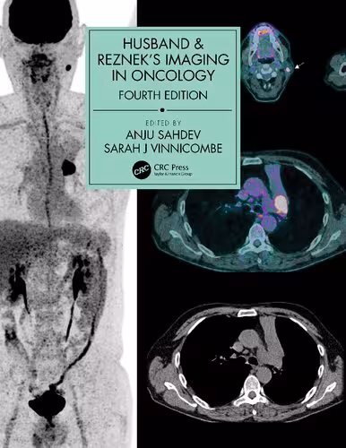 خرید و دانلود نسخه کامل کتاب Husband &amp; Reznek's Imaging in Oncology