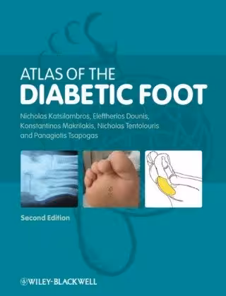 خرید و دانلود نسخه کامل کتاب Atlas of the Diabetic Foot, 2nd edition