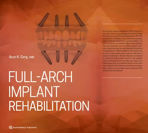 خرید و دانلود نسخه کامل کتاب Full-Arch Implant Rehabilitation