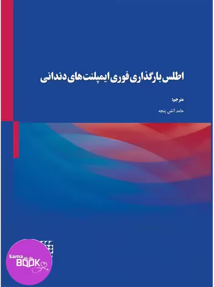 اطلس بارگذاری فوری ایمپلنت‌های دندانی