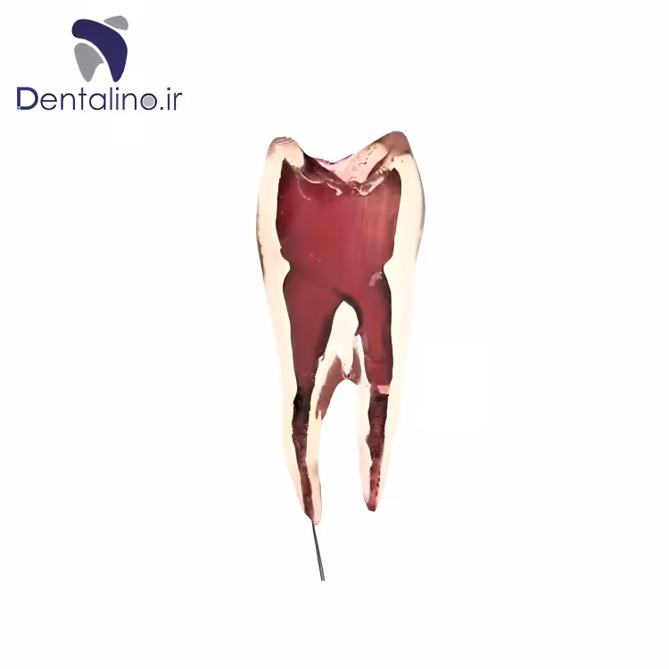 دندان تمرینی اندو