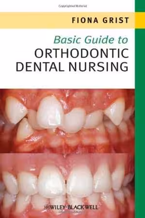 [PDF] دانلود کتاب Basic Guide To Orthodontic Dental Nursing, 2010