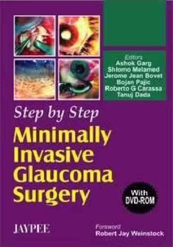 خرید و دانلود نسخه کامل کتاب Step by Step Minimally Invasive Cataract Surgery