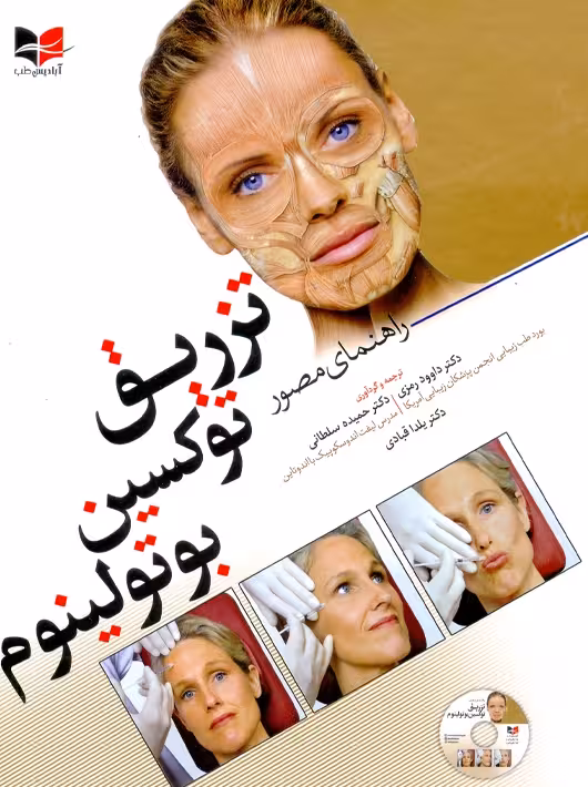 راهنمای مصور تزریق توکسین بوتولینوم رمزی آبادیس طب
