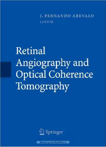 خرید و دانلود نسخه کامل کتاب Retinal Angiography and Optical Coherence Tomography