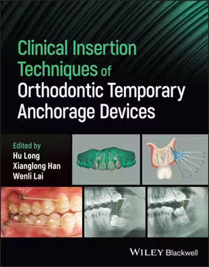 خرید و دانلود نسخه کامل کتاب Clinical Insertion Techniques of Orthodontic Temporary Anchorage Devices - Orginal Pdf