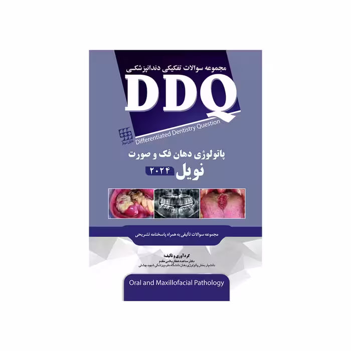 DDQ مجموعه سوالات تفکیکی دندانپزشکی پاتولوژی دهان، فک و صورت نویل 2024