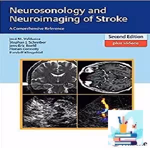 Neurosonology and Neuroimaging of Stroke TRUE PDF price 1€