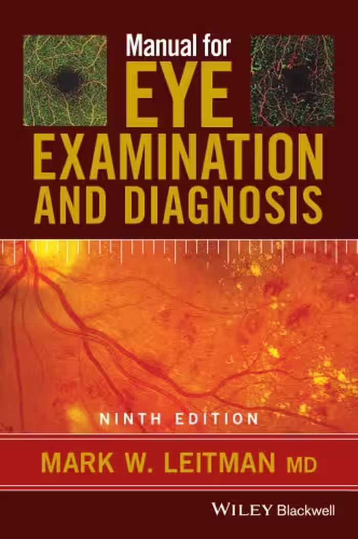 خرید و دانلود نسخه کامل کتاب Manual for Eye Examination and Diagnosis