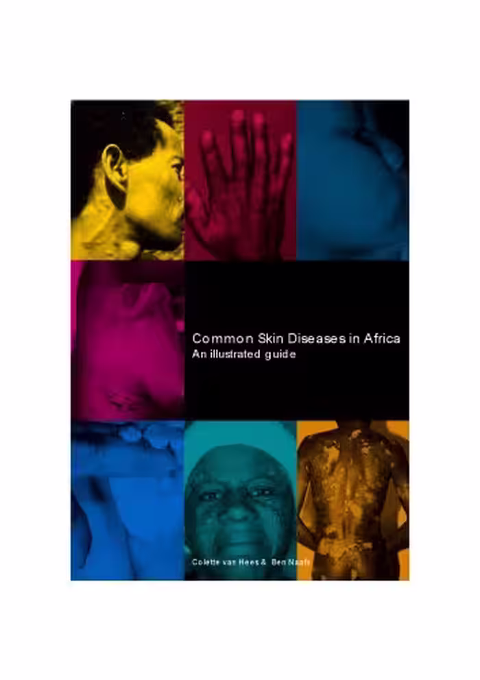 خرید و دانلود نسخه کامل کتاب Common Skin Diseases in Africa : an Illustrated Guide