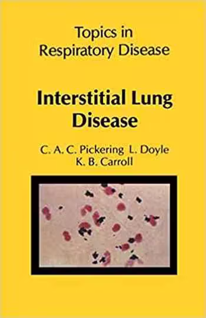 [PDF] دانلود کتاب Interstitial Lung Disease, 1981