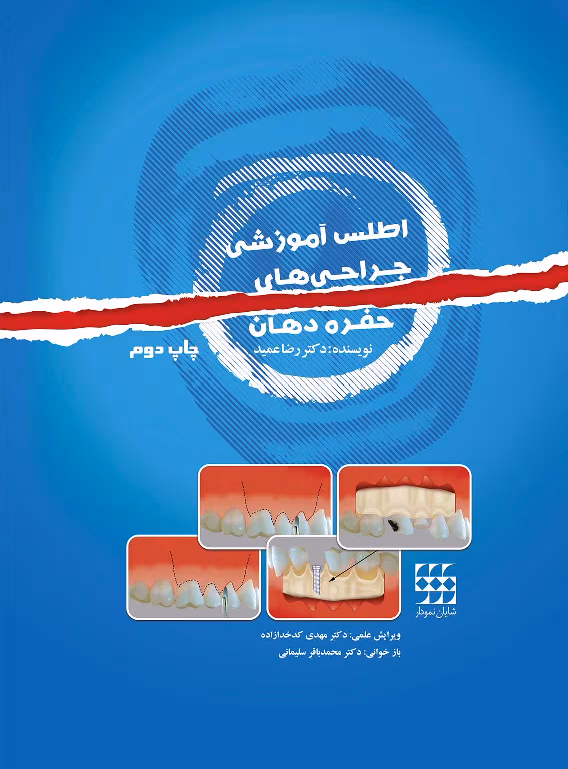 کتاب اطلس آموزشی جراحی های حفره دهان