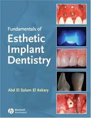[PDF] دانلود کتاب Fundamentals Of Esthetic Implant Dentistry, 2nd ed, 2008