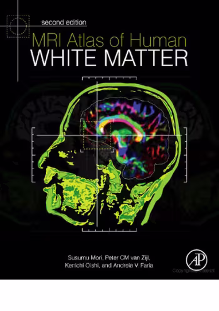 خرید و دانلود نسخه کامل کتاب MRI Atlas of Human White Matter