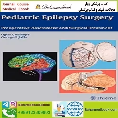 Pediatric Epilepsy Surgery Preoperative Assessment and Surgica