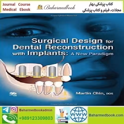 Surgical Design for Dental Reconstruction with Implants 2016